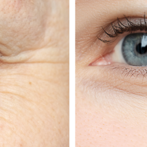 12-Minute Wrinkle Reducer 12-Minute Wrinkle Reducer